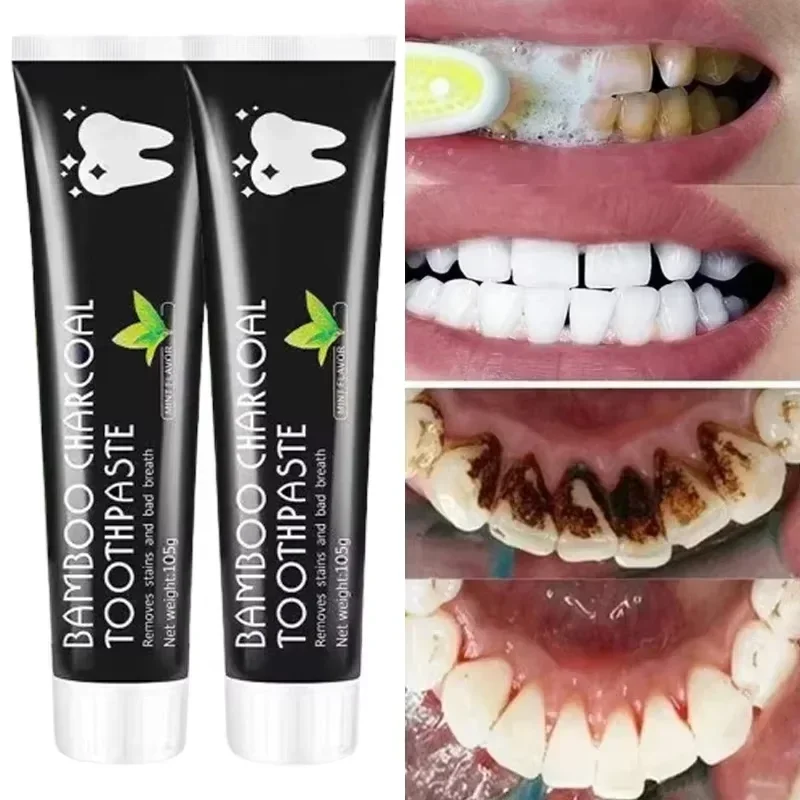 Teeth Whitening Charcoal - Pasta de Dente Clareadora com Carvão